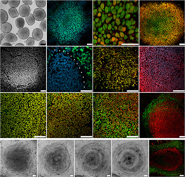 Искусственная сетчатка глаза на разных стадиях развития. Микрофотографии: Zhong et al. / Nature /NPG